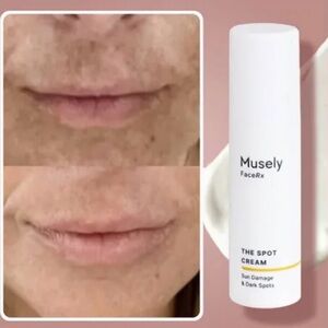 Musely FaceRx Spot Cream